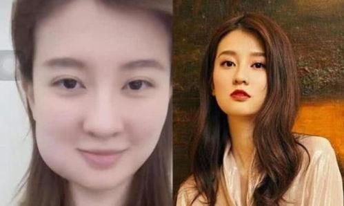 整牙吃瓜,揭秘明星吃瓜背后的美丽蜕变